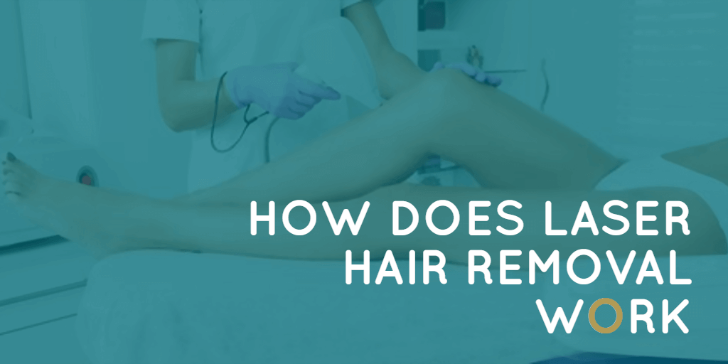 HOW DOES LASER HAIR REMOVAL WORK? (2020 STEP-BY-STEP GUIDE)
